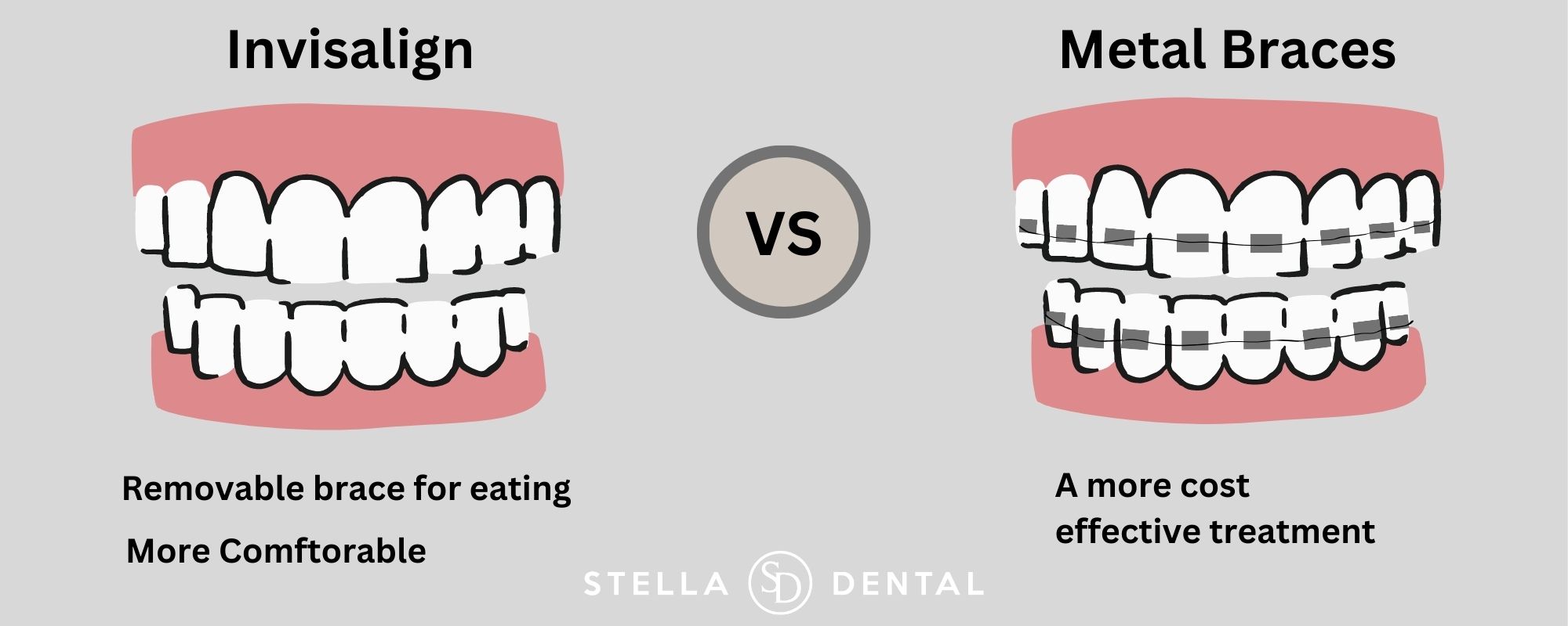Invisalign Vs Metal Braces Stella Dental Stafford Dentist