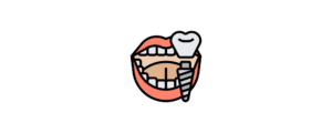 A graphic of a dental implant showing the screw and tooth ontop.