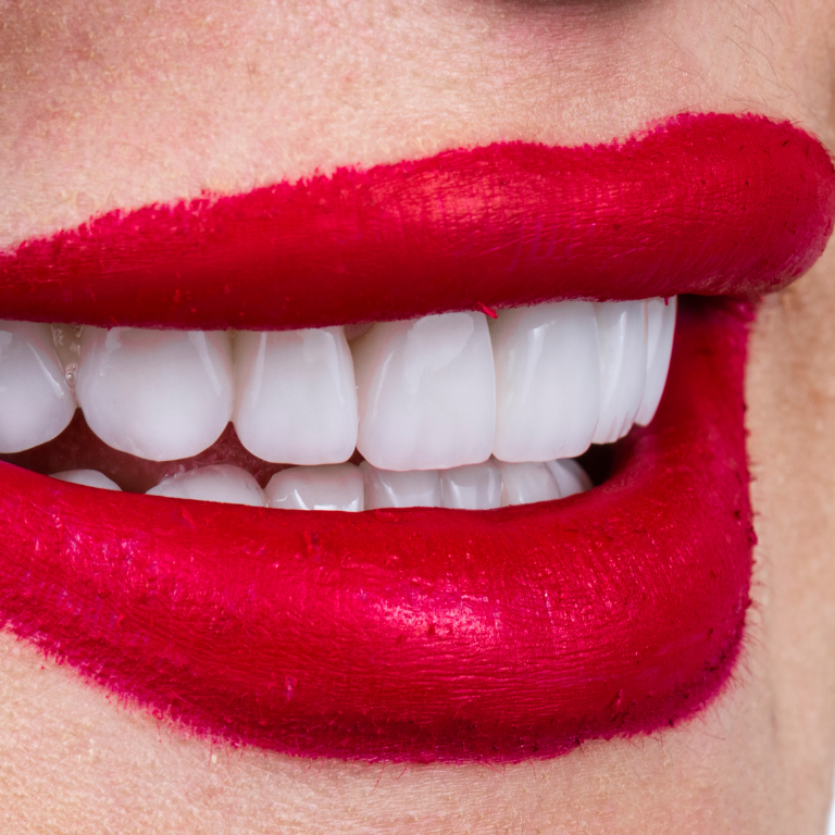 Veneers in Stafford Tooth Veneers Stella Dental Stafford