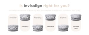 Is Invisalign Right For You? - Stafford Dental Practice