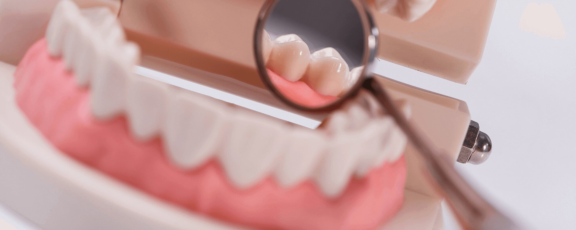 A close-up of a dental implant model with a small dentist's mirror showing behind the teeth, showing their natural look.