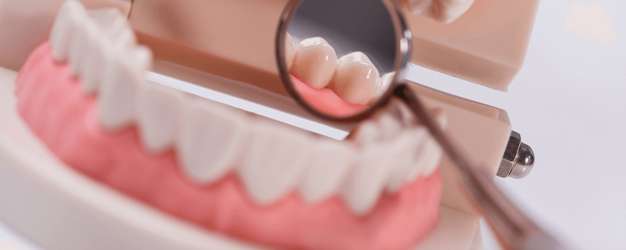 Close up of a dental implant model