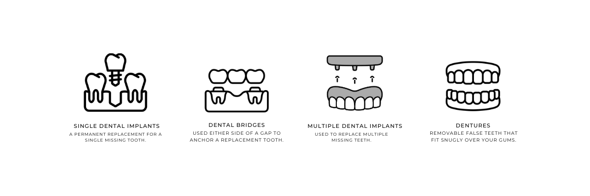 Different types of dental implants infographic Single dental implants - a permanent replacement for a single missing tooth Dental bridges - used either side of a gap to anchor a replacement tooth Multiple dental implants - used to replace multiple missing teeth Dentures - removable false teeth that fit snuggly over your gums Stella Dental - Stafford Dental Practice