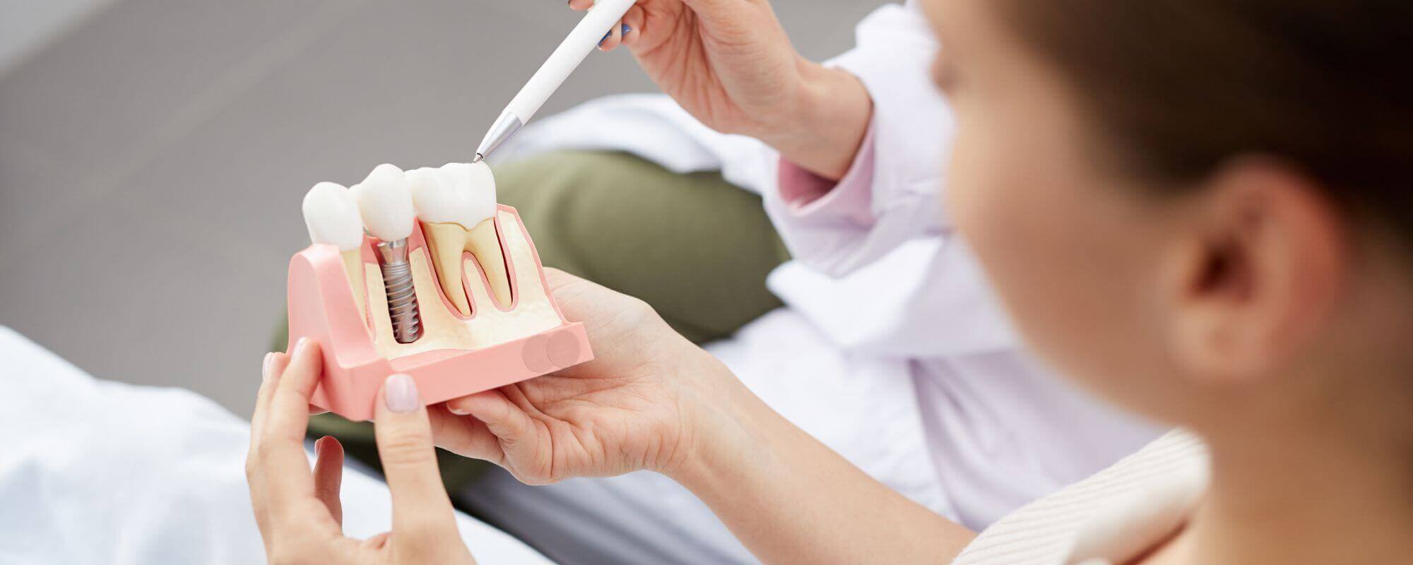 A woman holding a model of dental implants whilst a dentist is pointing towards the top of the model tooth at our dental practice located in Stafford.