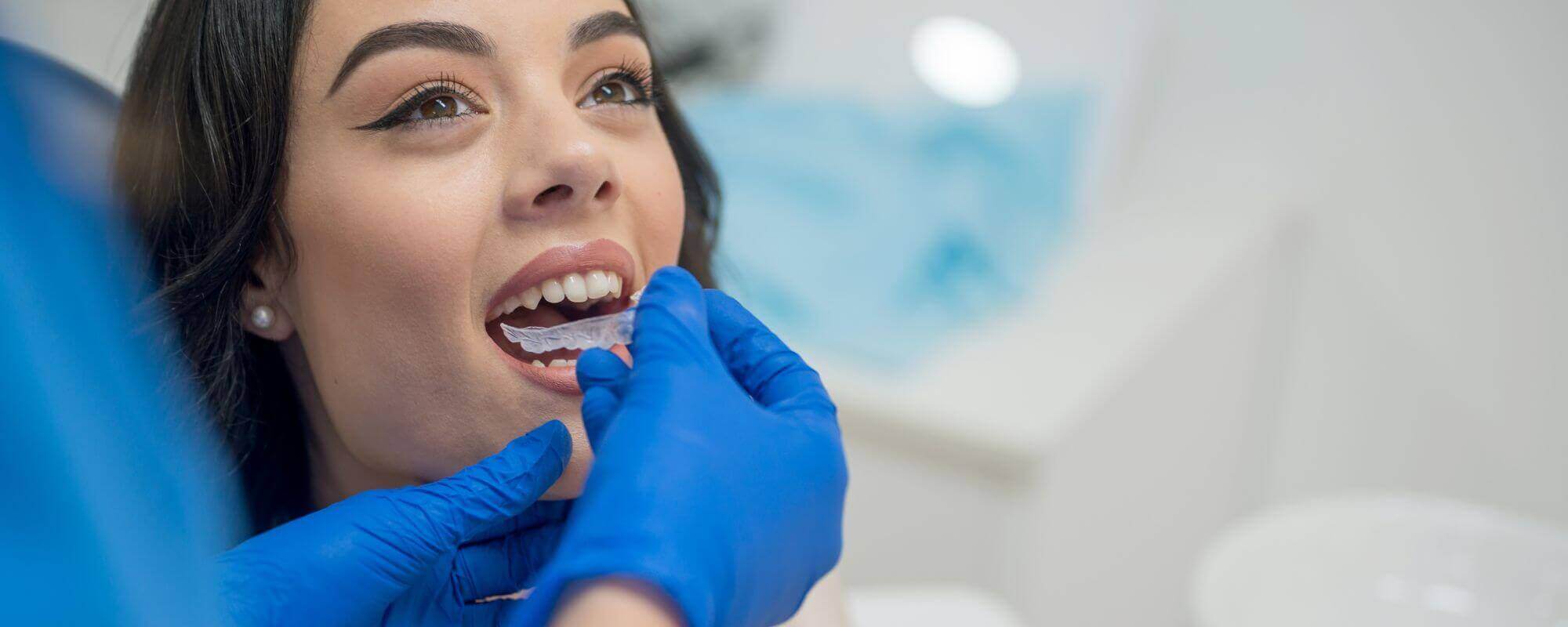 Woman getting Invisalign Clear braces tray into mouth at Stella Dental Suite for straighter teeth - Stafford dental practice