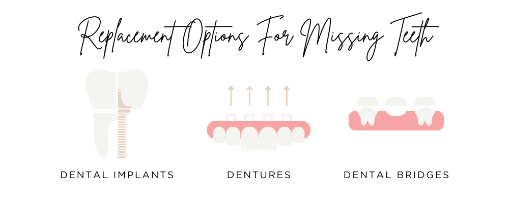 Replacement Options For Missing Teeth as follows; Dental Implants, Dentures and Dental Bridges - Stafford dental practice