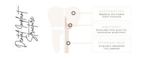 An infographic of a dental implants structure and what they are made of 