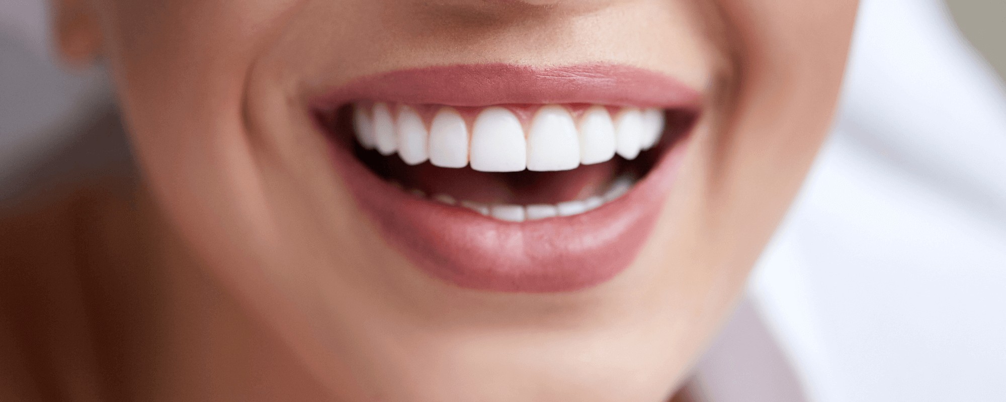 A close-up of a woman's bright white smile with dental implants, after choosing between the types of dental implants, smiling towards the camera here at Stella Dental in Staffordshire.