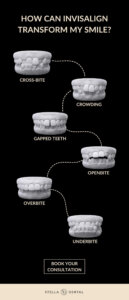 Invisalign Infographic showing what can be fixed with Invisalign