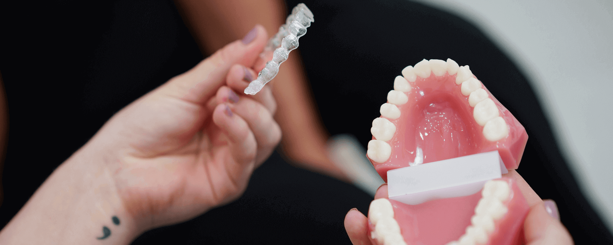 Invisalign aligners being put onto a dental model during Invisalign consultation