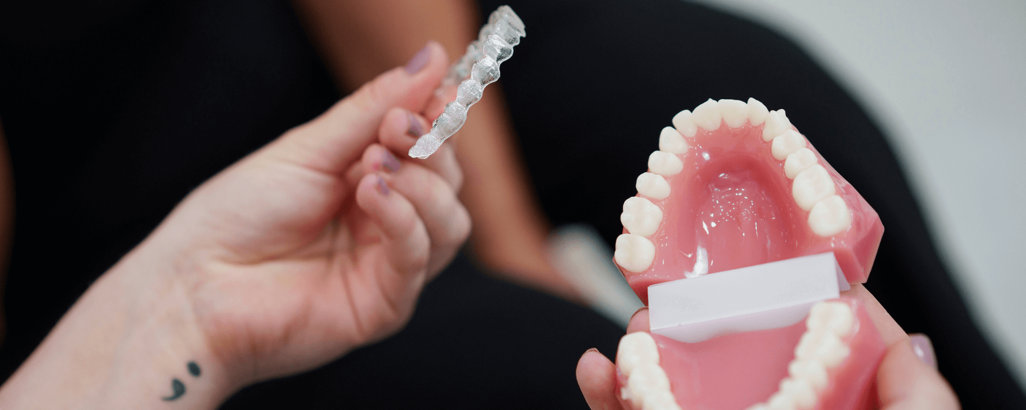 Are Invisalign Braces Worth It? Stella Dental Stafford