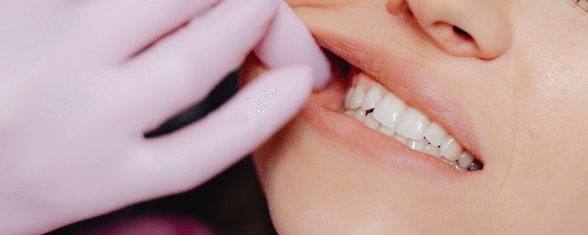 woman after getting dental implants